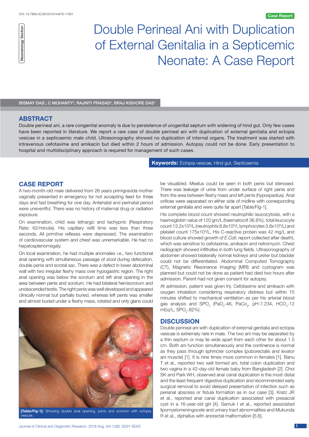 Double Perineal Ani with Duplication of External Genitalia in a Septicemic