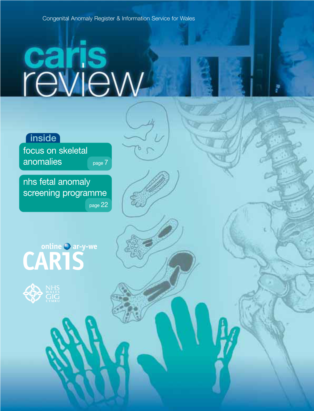 Focus on Skeletal Anomalies Page 7 Nhs Fetal Anomaly Screening Programme Page 22