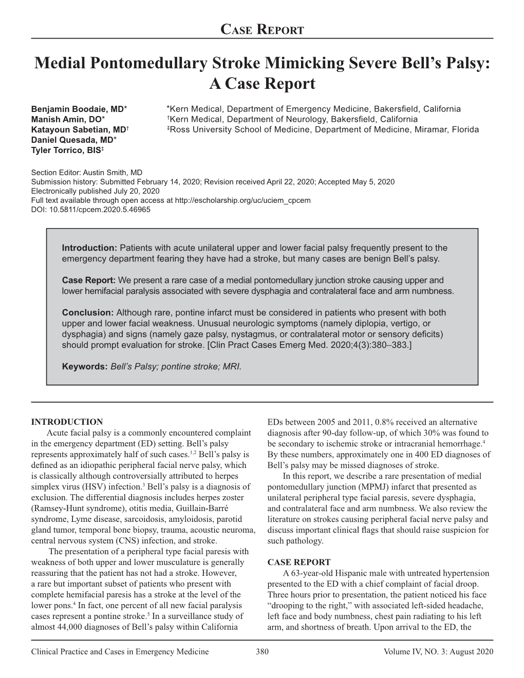 Medial Pontomedullary Stroke Mimicking Severe Bell’S Palsy