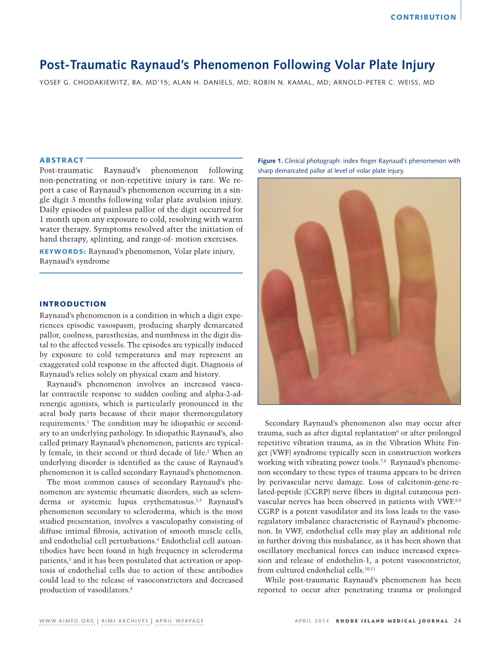 Post-Traumatic Raynaud's Phenomenon Following Volar Plate