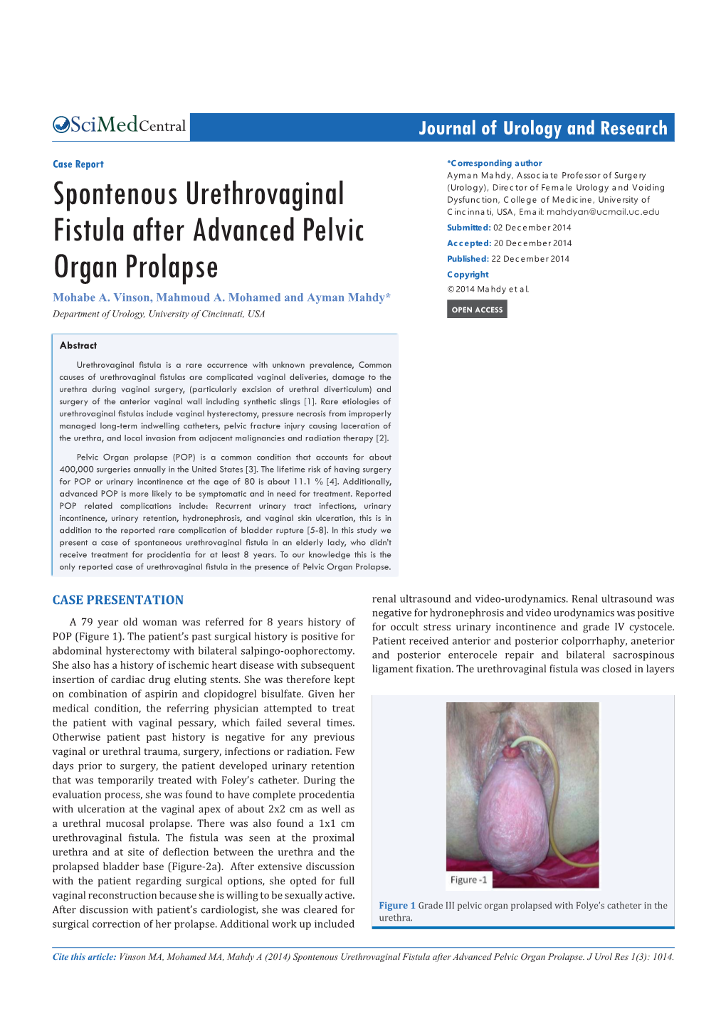 Spontenous Urethrovaginal Fistula After Advanced Pelvic Organ Prolapse