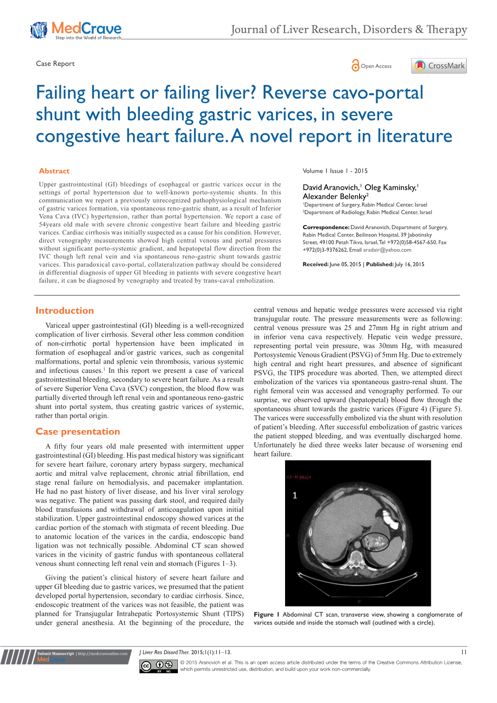 Reverse Cavo-Portal Shunt with Bleeding Gastric Varices, in Severe Congestive Heart Failure