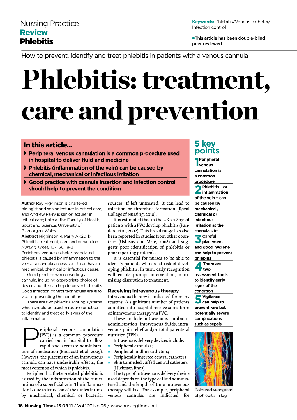 Phlebitis: Treatment, Care and Prevention