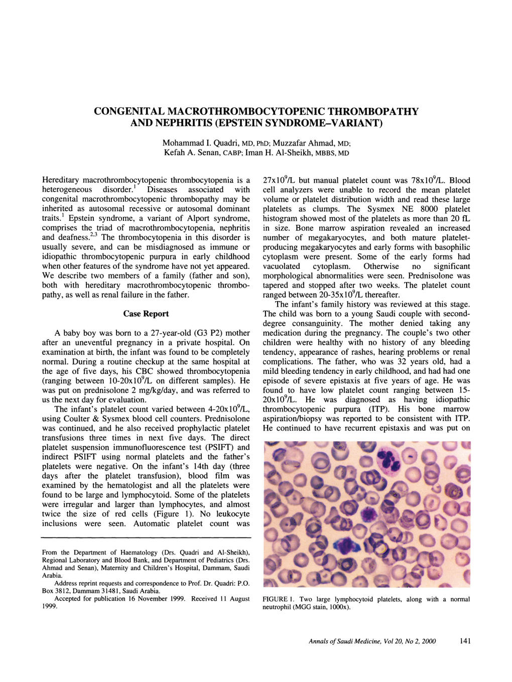 Congenital Macrothrombocytopenic Thrombopathy and Nephritis (Epstein Syndrome-Variant)