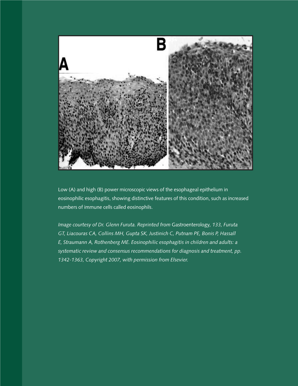 Diseases of the Oropharynx and Esophagus