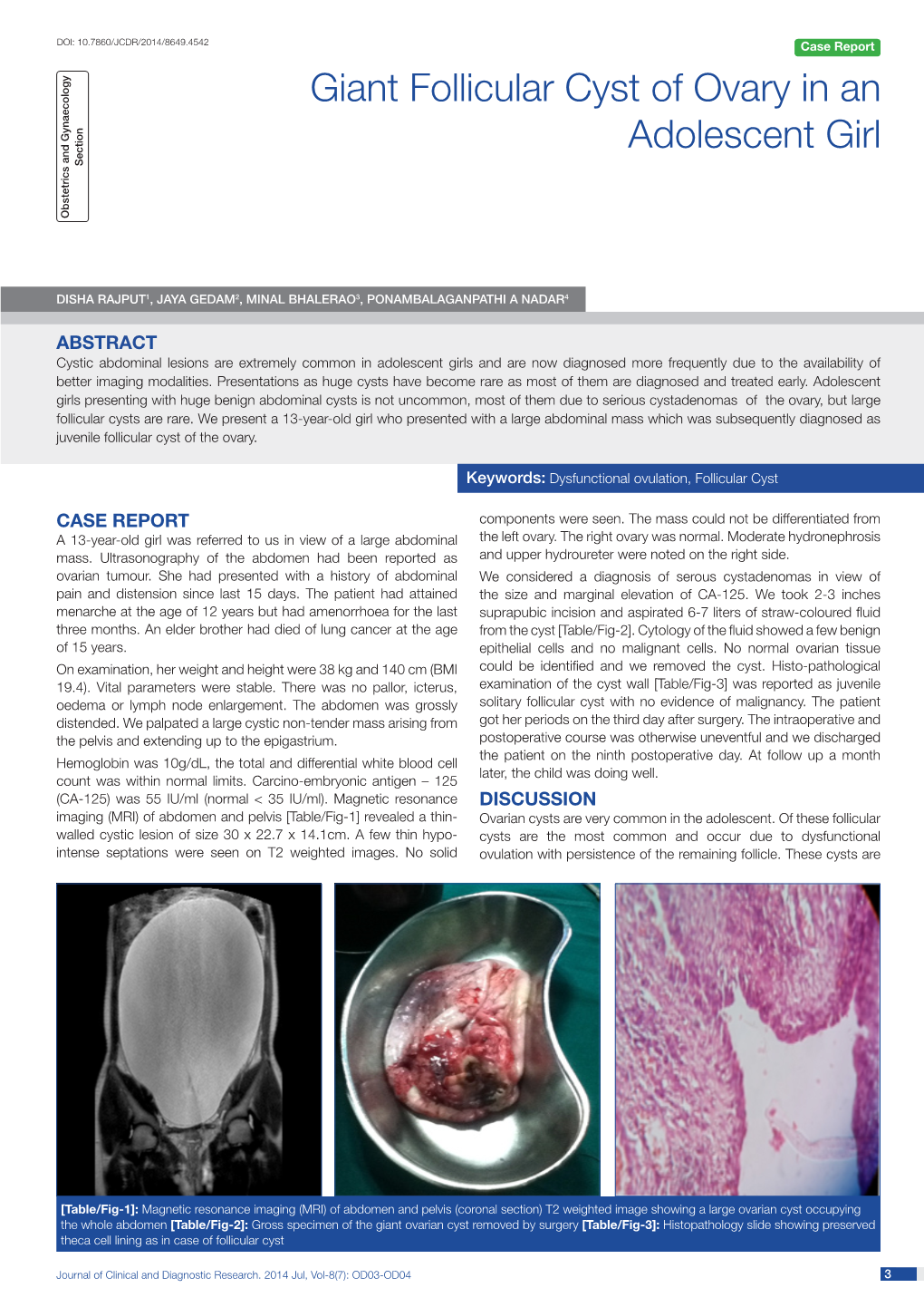 Giant Follicular Cyst of Ovary in an Adolescent Girl S Ection O Bstetrics and Gynaecology