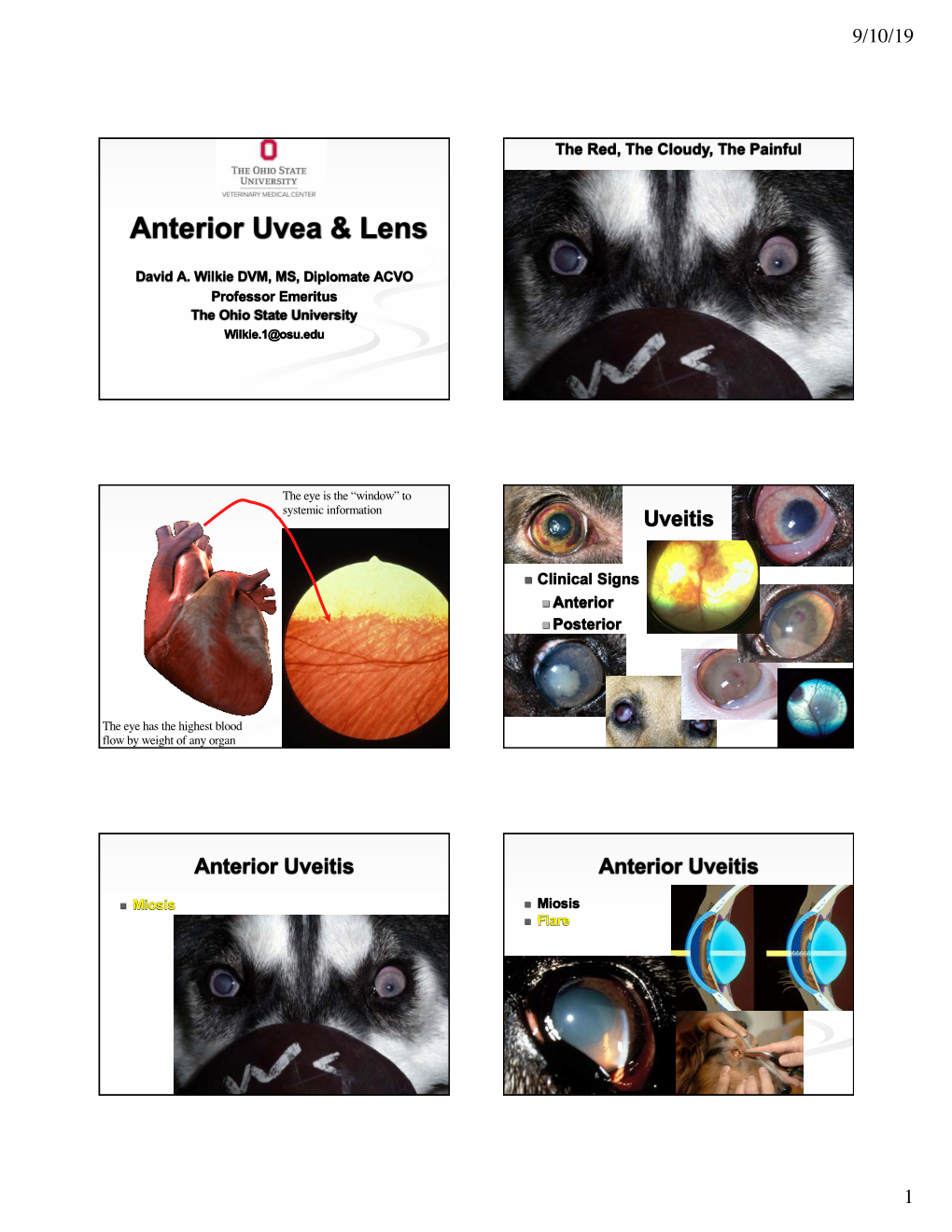 Anterior Uvea & Lens