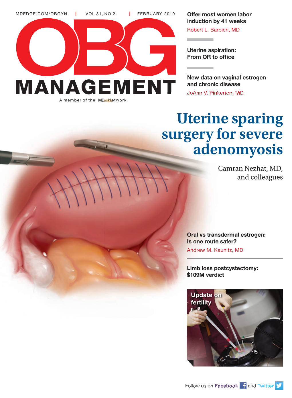 Uterine Sparing Surgery for Severe Adenomyosis