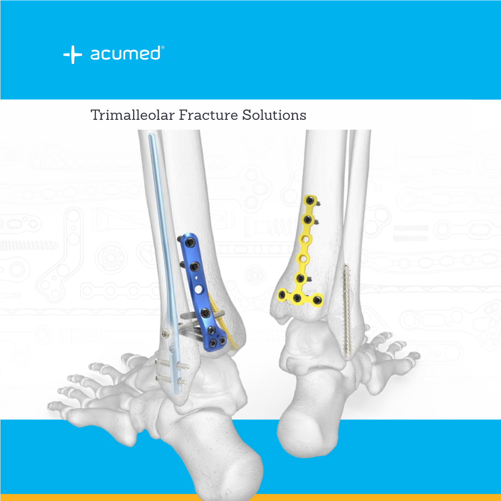 Trimalleolar Fracture Solutions