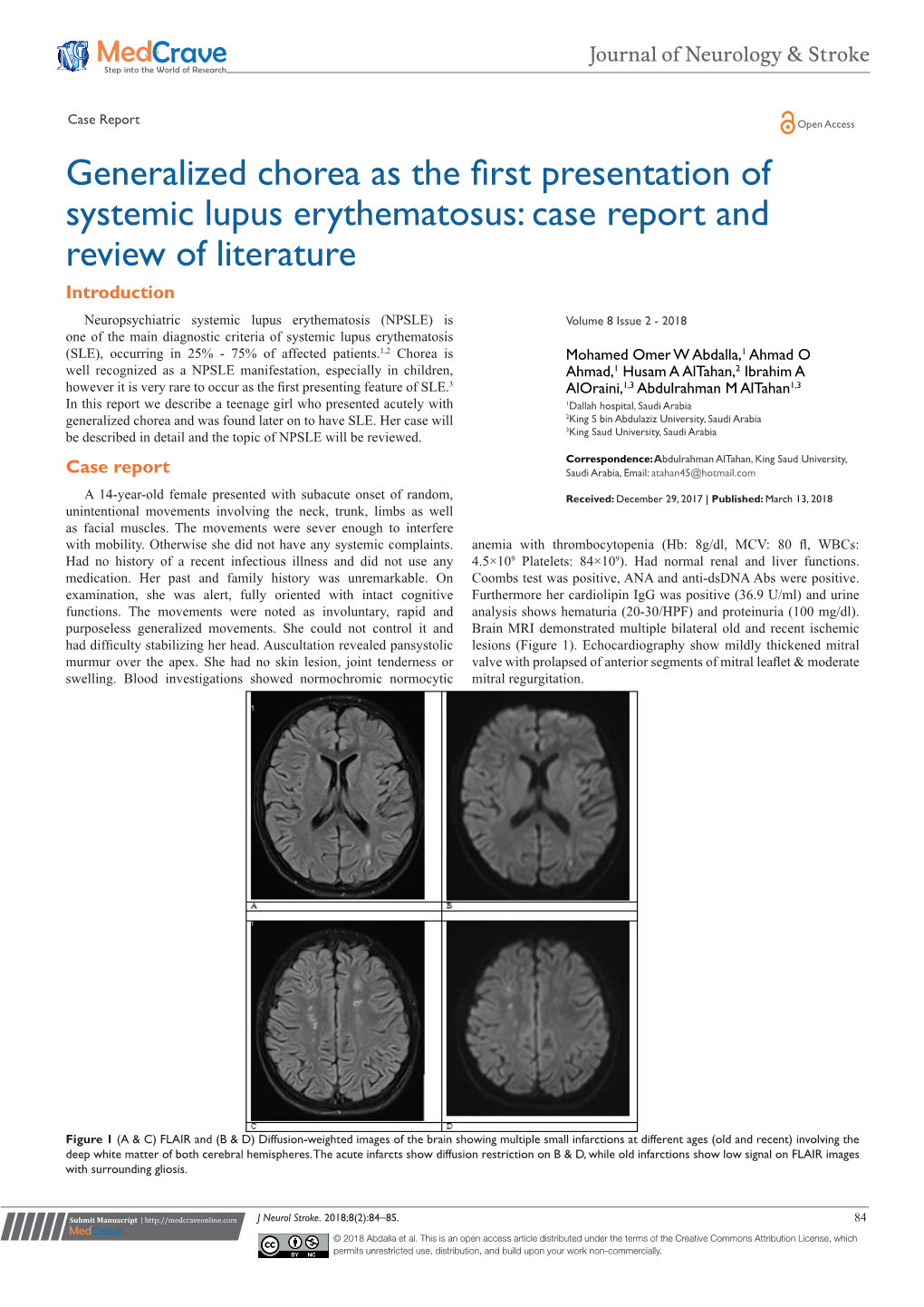 Generalized Chorea As the First Presentation Of