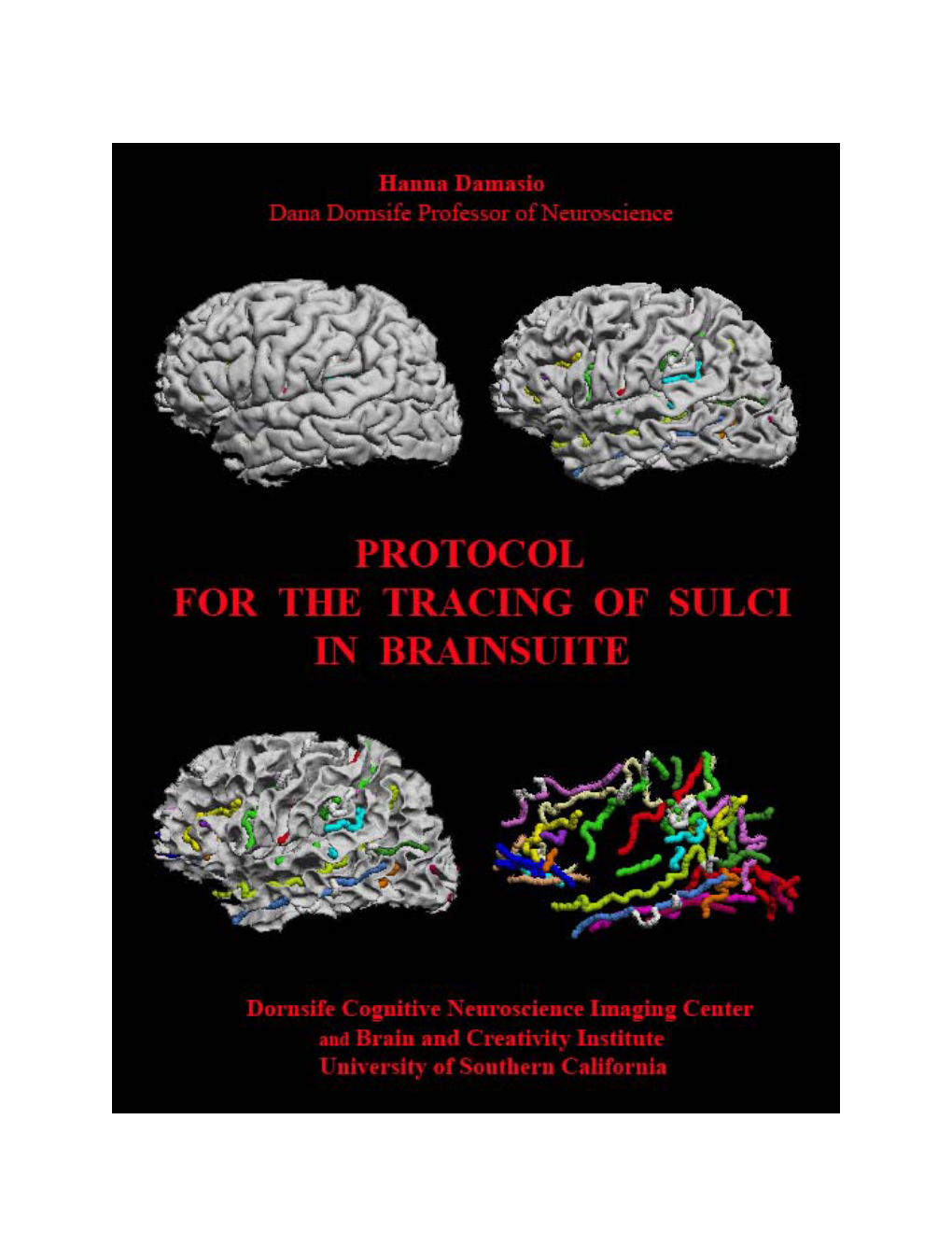 Sulci-Tracing Protocol.Pdf