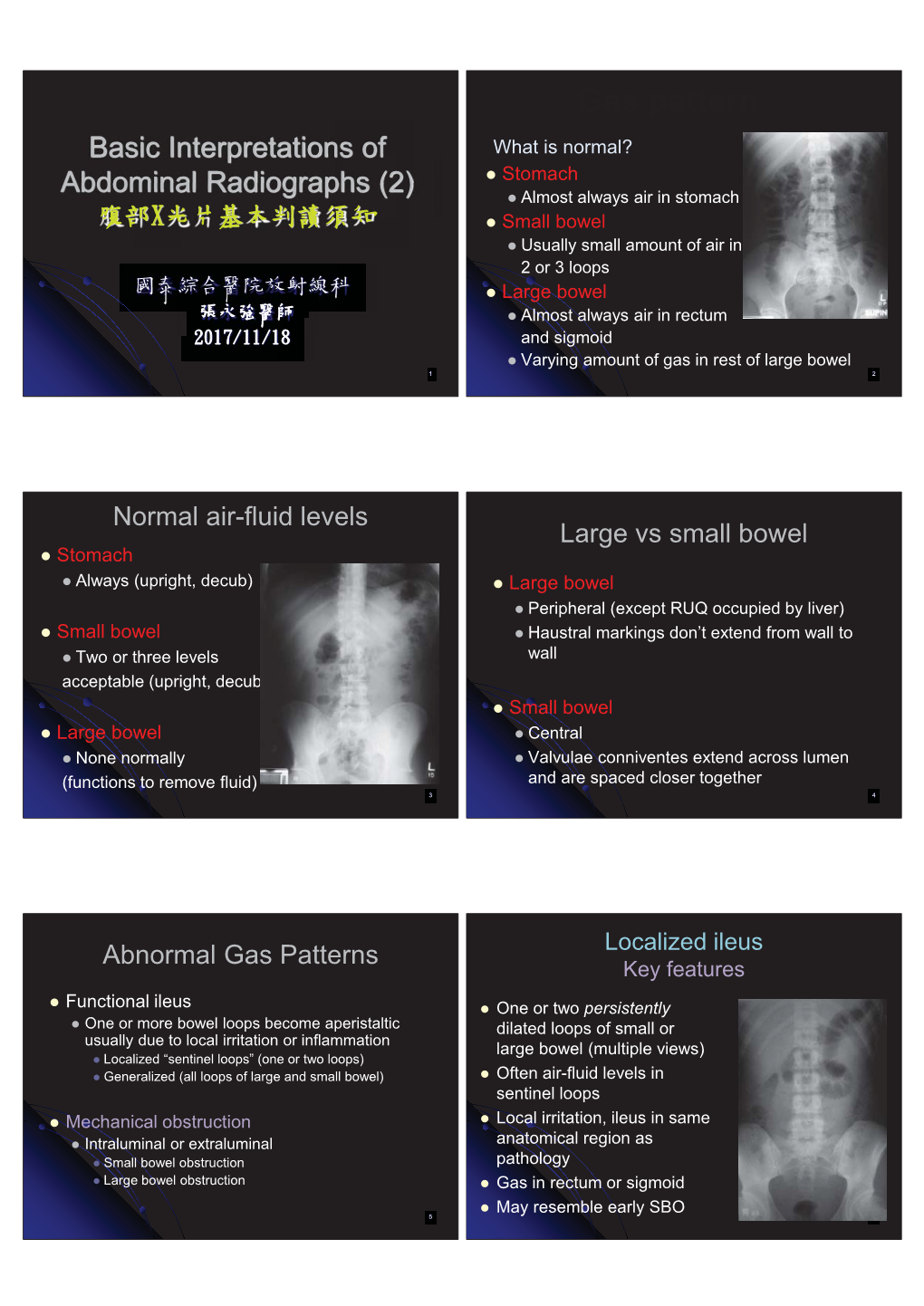 Basic Principles in Interpretation of Abdominal Radiograph