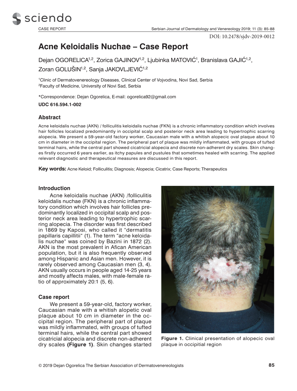 Acne Keloidalis Nuchae – Case Report