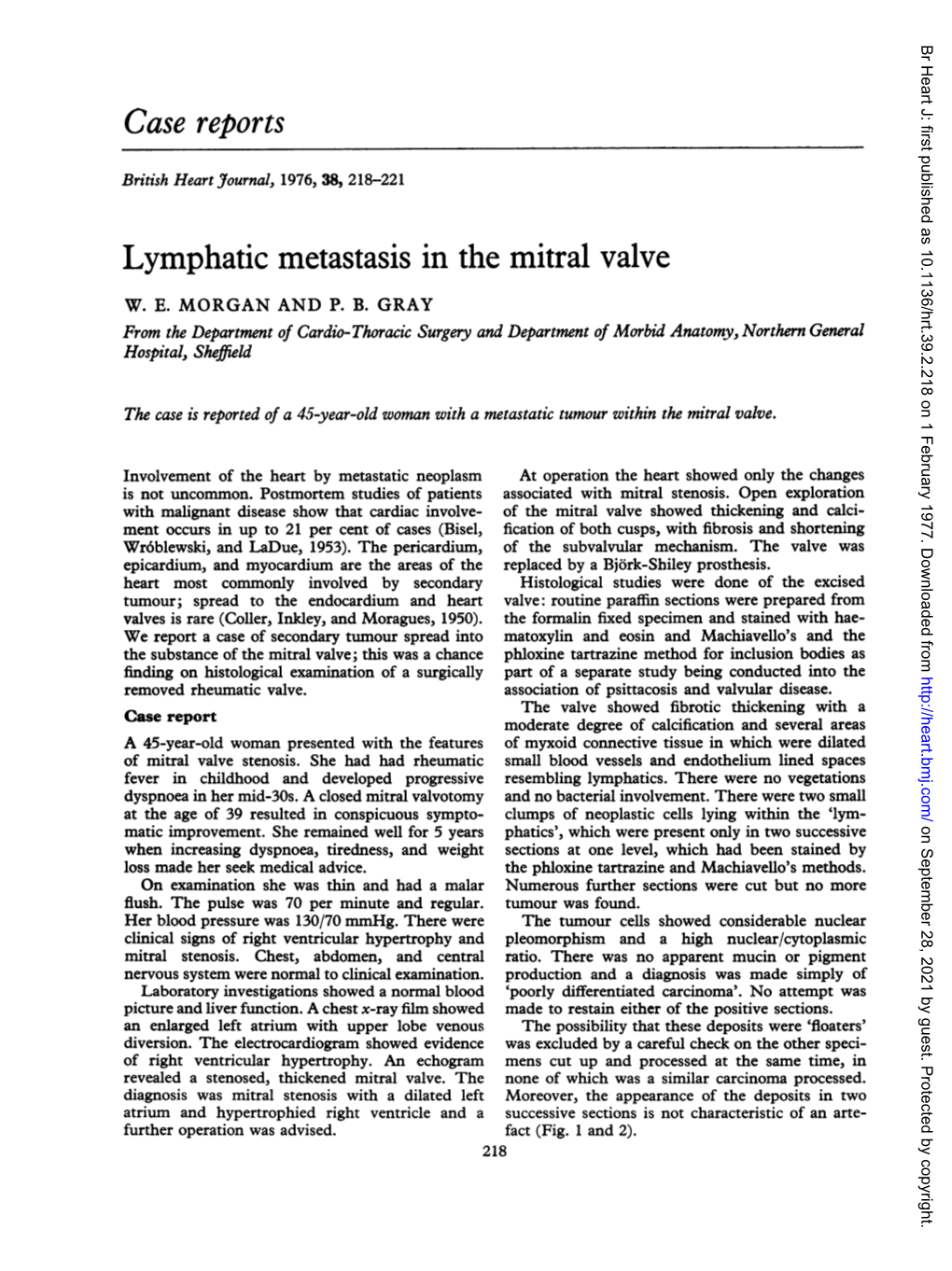 Lymphatic Metastasis in the Mitral Valve W