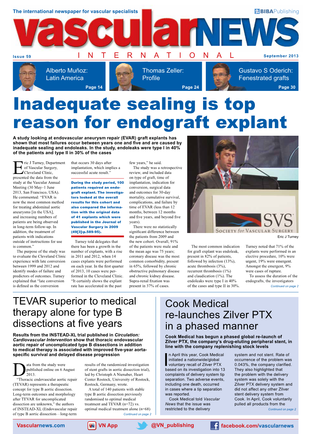 Inadequate Sealing Is Top Reason for Endograft Explant