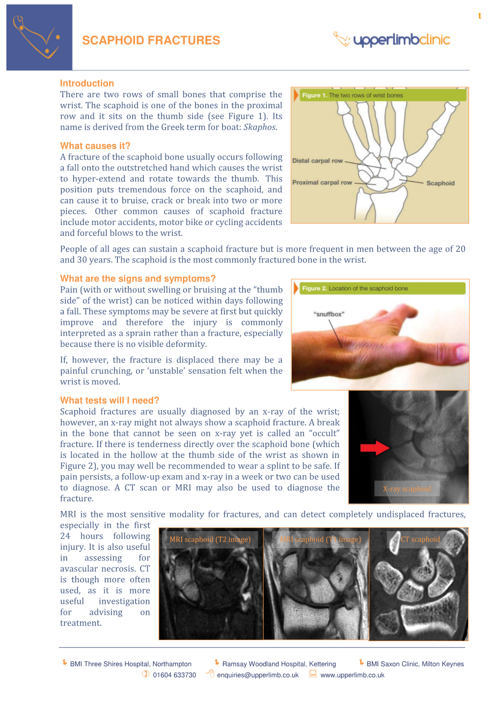 Scaphoid Fractures