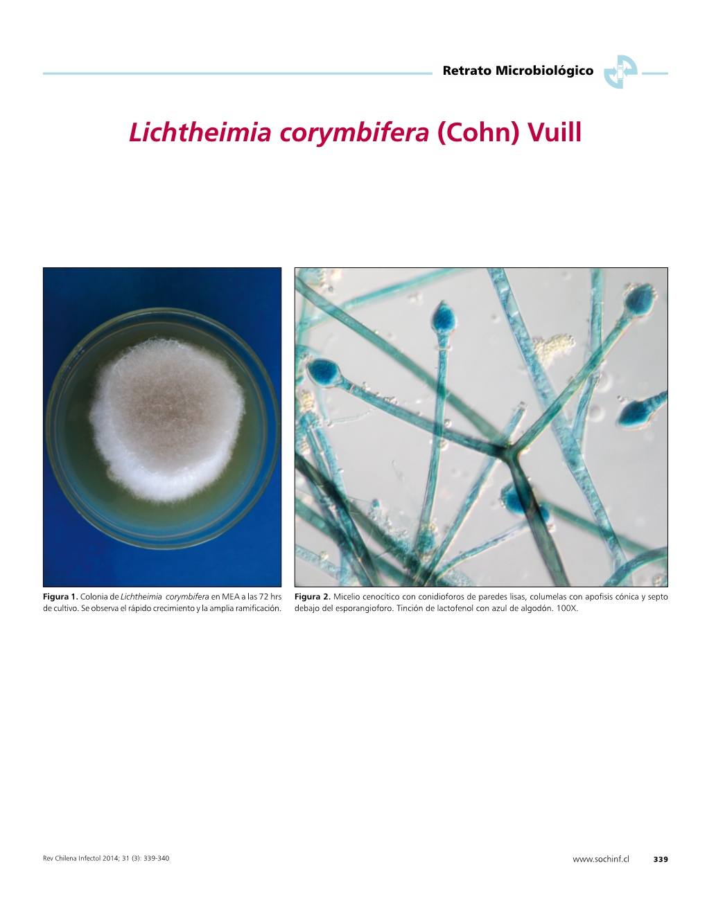 Lichtheimia Corymbifera (Cohn) Vuill