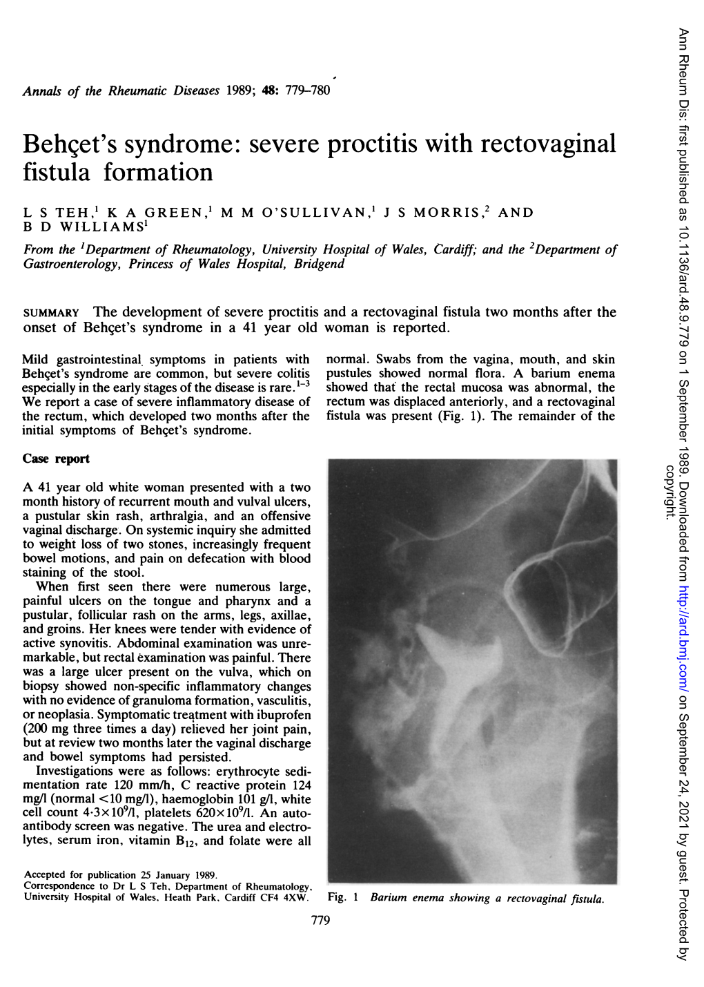 Behqet's Syndrome: Severe Proctitis with Rectovaginal Fistula Formation