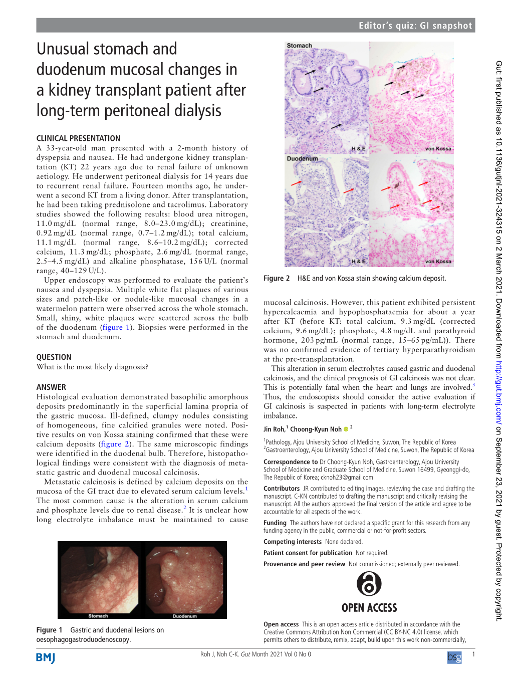 Unusual Stomach and Duodenum Mucosal Changes in a Kidney