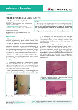 Pilomatricoma: a Case Report