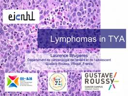 Anaplastic Large Cell Lymphoma in Children