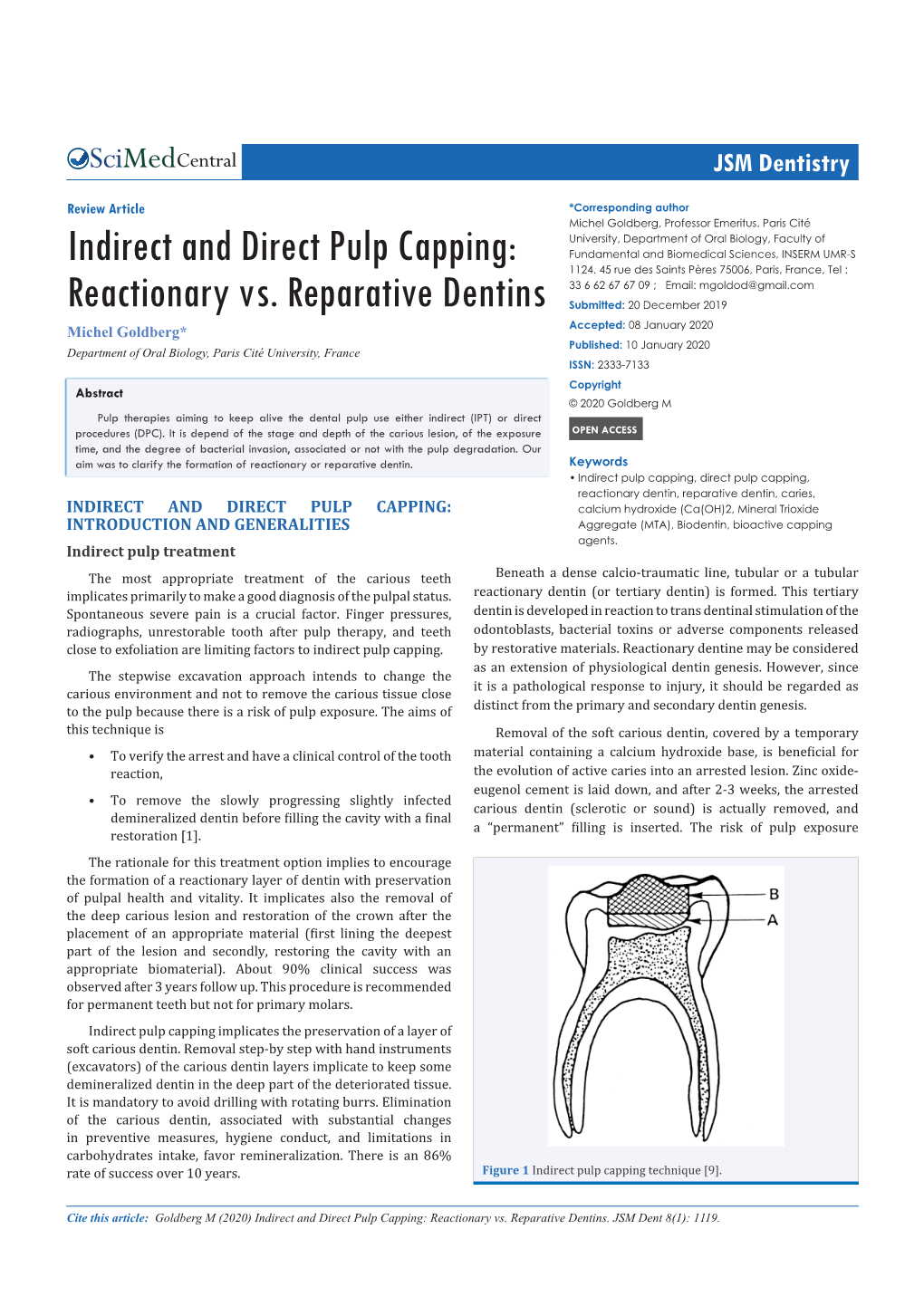 Indirect and Direct Pulp Capping: Reactionary Vs. Reparative Dentins