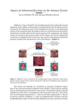Impact of Adenotonsillectomy on the Immune System Javier Dibildox M