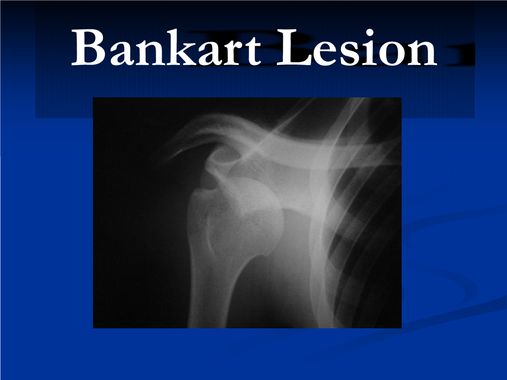 Bankart Lesion Normal Anatomy