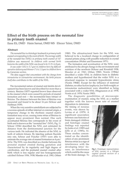 Effect of the Birth Process on the Neonatal Line in Primary Tooth Enamel Dana Eli, DMD Haim Sarnat, DMD MS Eliezer Talmi, DMD