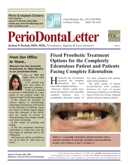 Full-Arch, Implant- Supported Metal- Ceramic Fixed Dentures