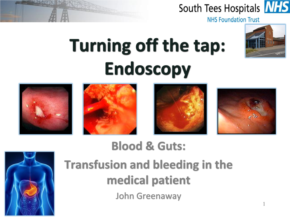 Turning Off the Tap: Endoscopy