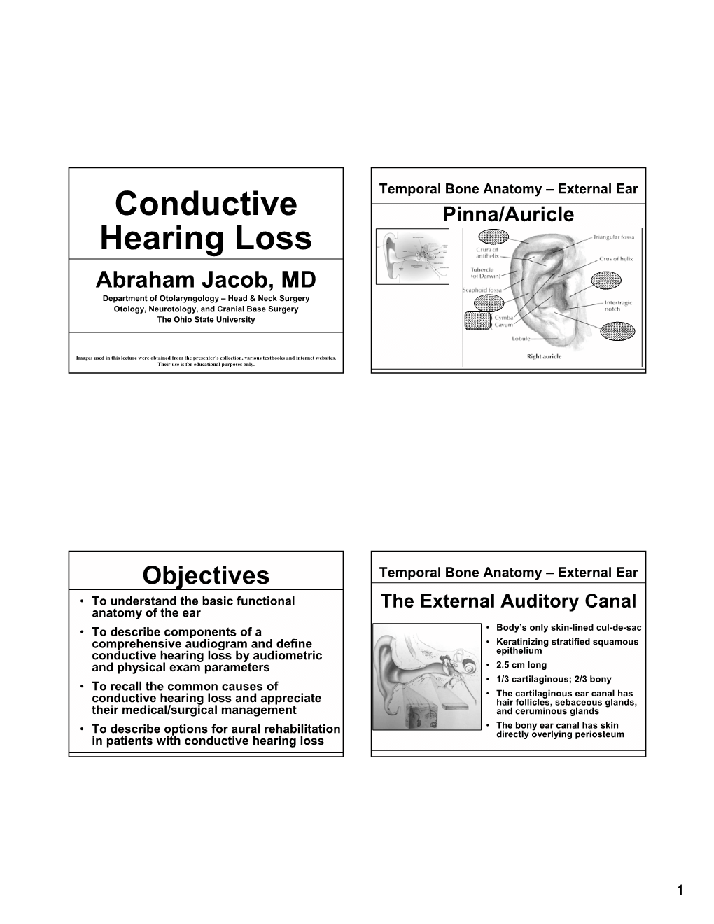 Conductive Hearing Loss