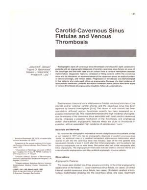 Carotid-Cavernous Sinus Fistulas and Venous Thrombosis
