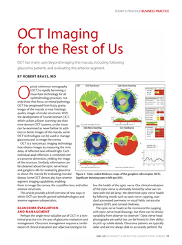 OCT Imaging for the Rest of Us