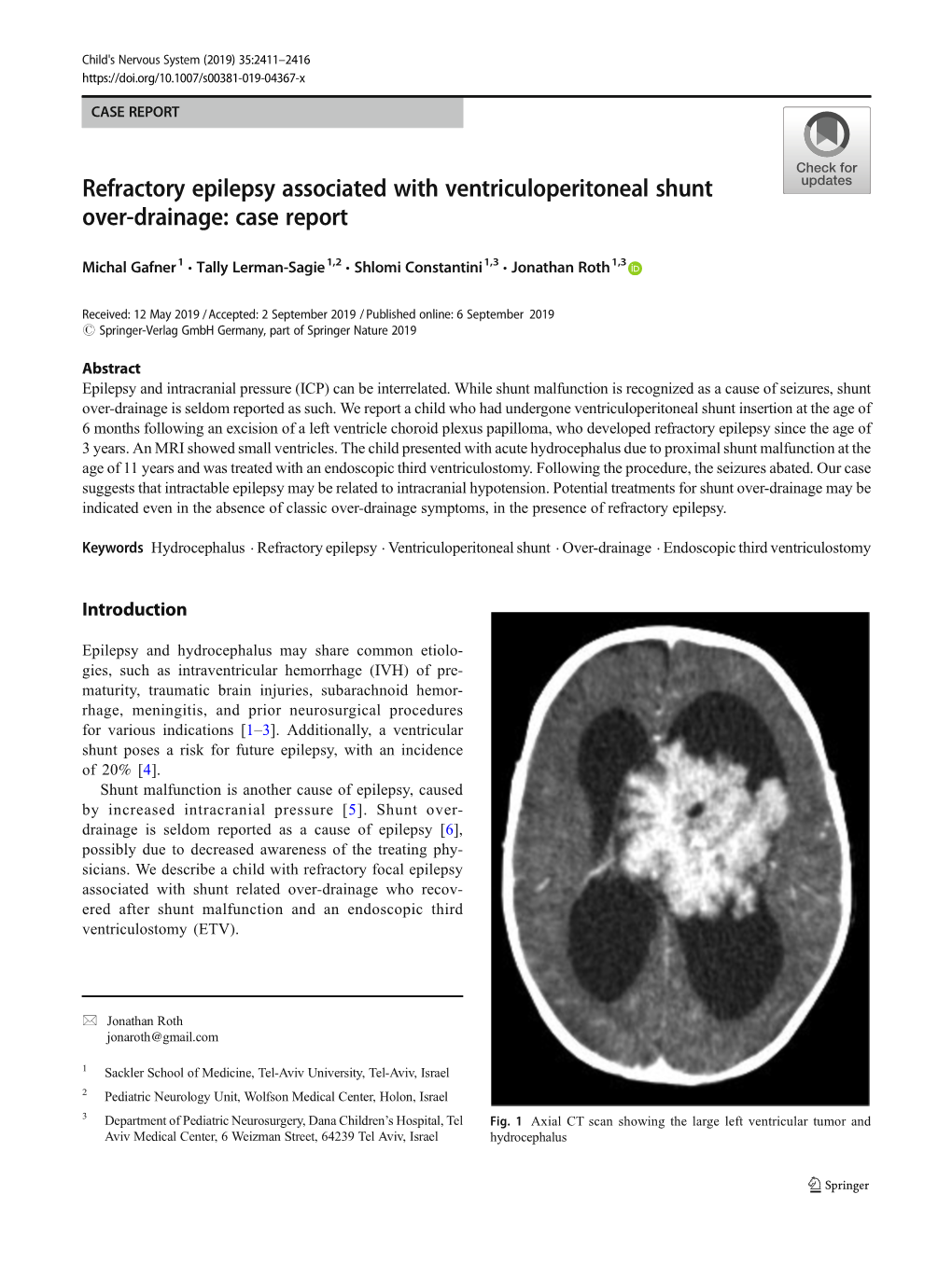 Refractory Epilepsy Associated with Ventriculoperitoneal Shunt Over-Drainage: Case Report