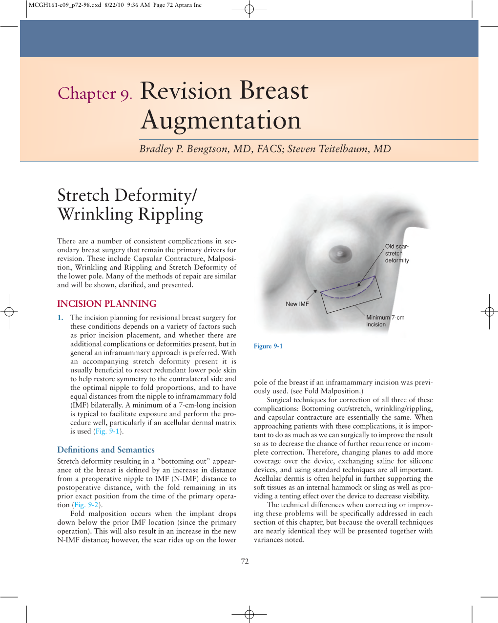 Chapter 9. Revision Breast Augmentation Bradley P