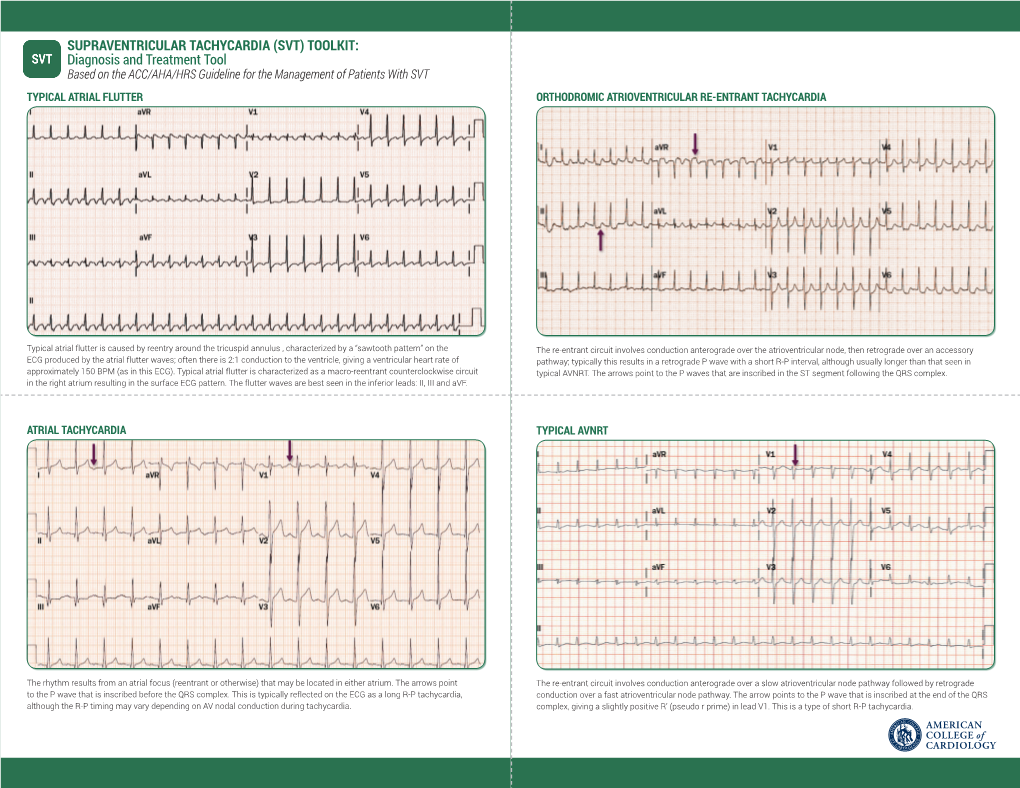 Supraventricular Tachycardia (Svt) Toolkit