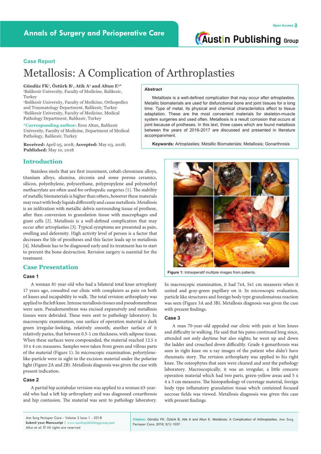 Metallosis: a Complication of Arthroplasties