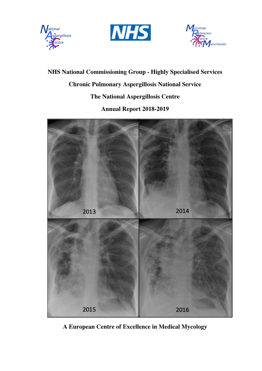 Chronic Pulmonary Aspergillosis Annual Report 2018-19 Final