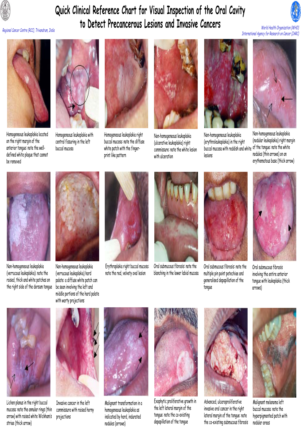 Quick Clinical Reference Chart for Visual Inspection of the Oral Cavity