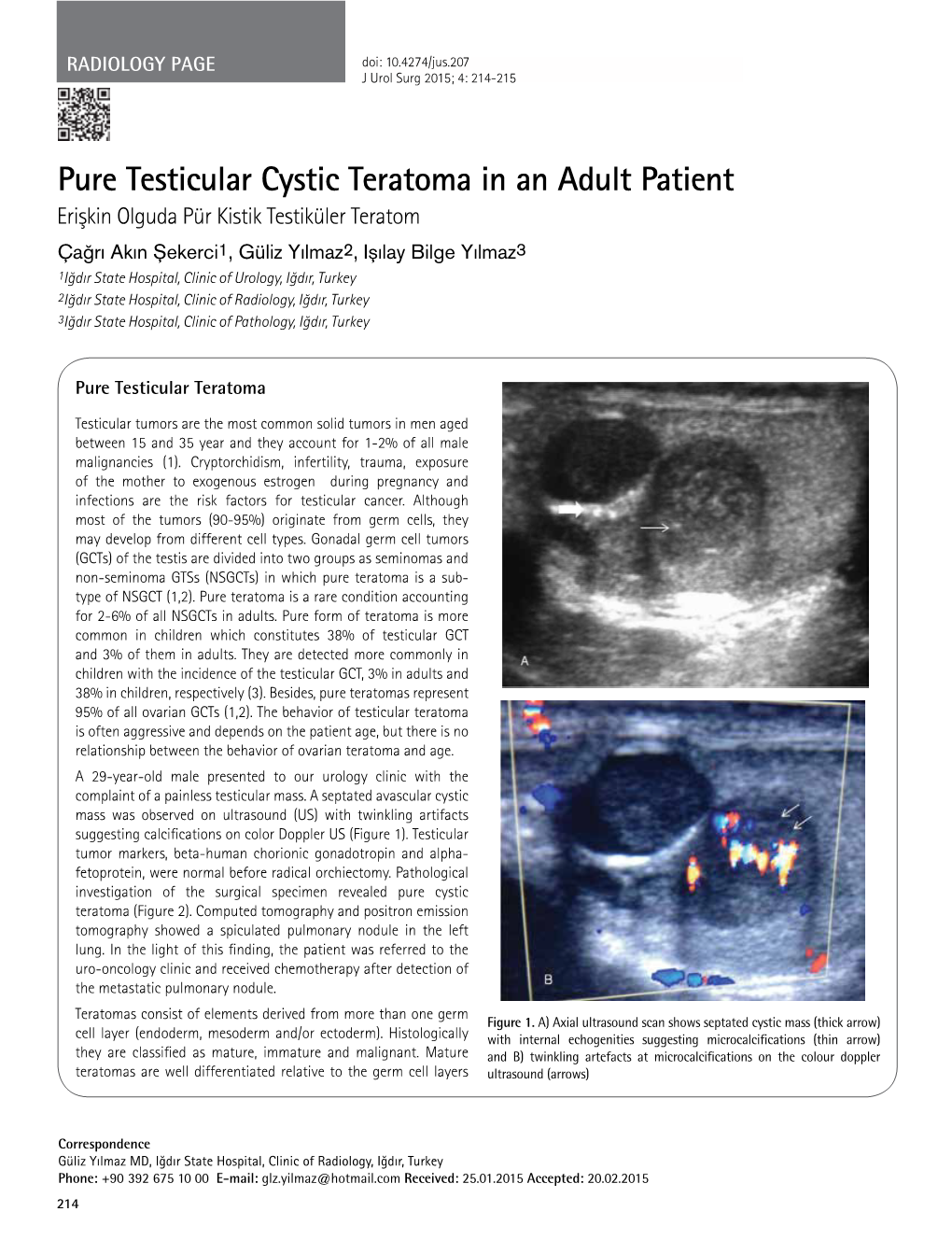 Pure Testicular Cystic Teratoma in an Adult Patient