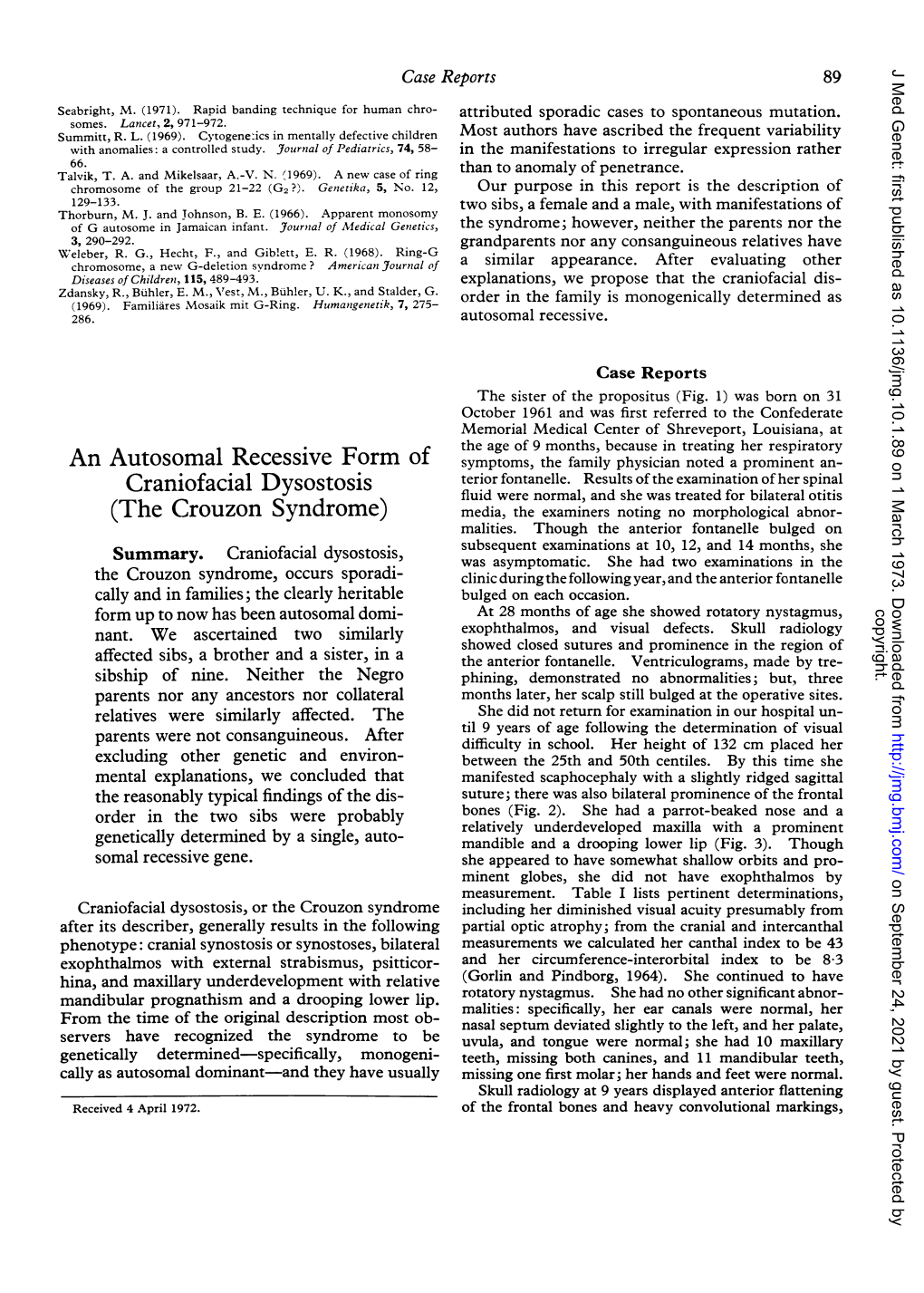 Craniofacial Dysostosis (The Crouzon Syndrome)