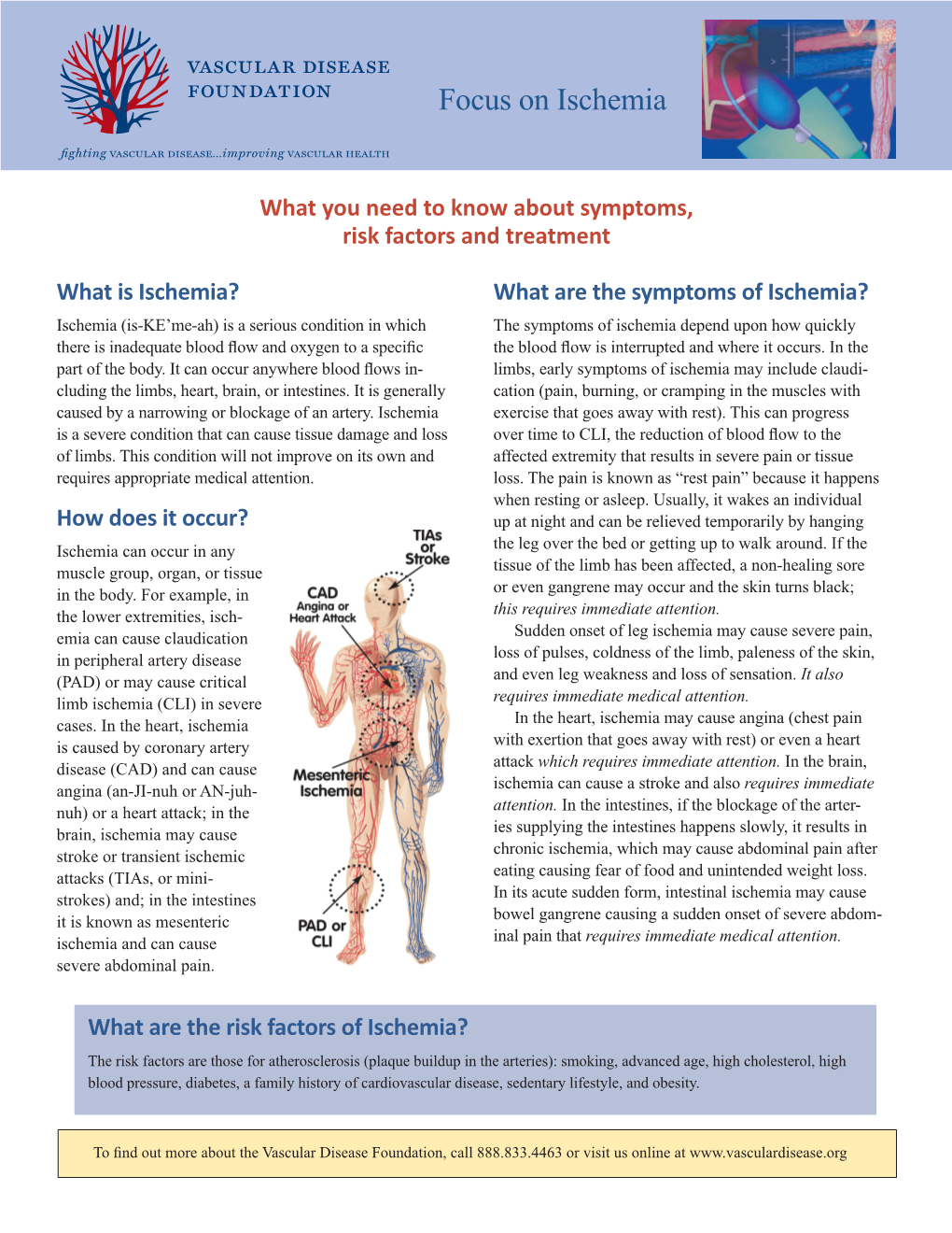 Focus on Ischemia