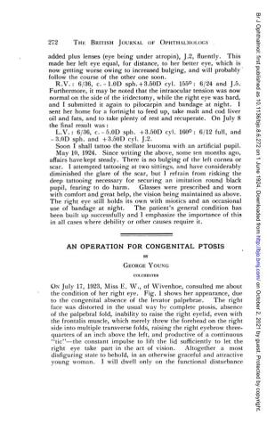 An Operation for Congenital Ptosis by George Young