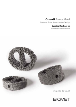 Osseoti Porous Metal Foot and Ankle Reconstructive Wedge Surgical Technique Evans Protocol with Profile 1