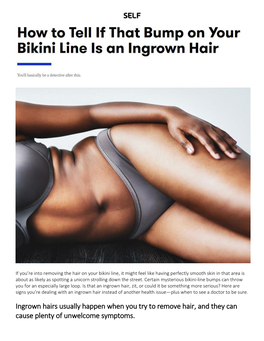 Ingrown Hairs Usually Happen When You Try to Remove Hair, and They Can Cause Plenty of Unwelcome Symptoms