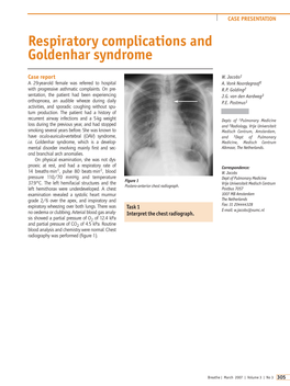 Respiratory Complications and Goldenhar Syndrome