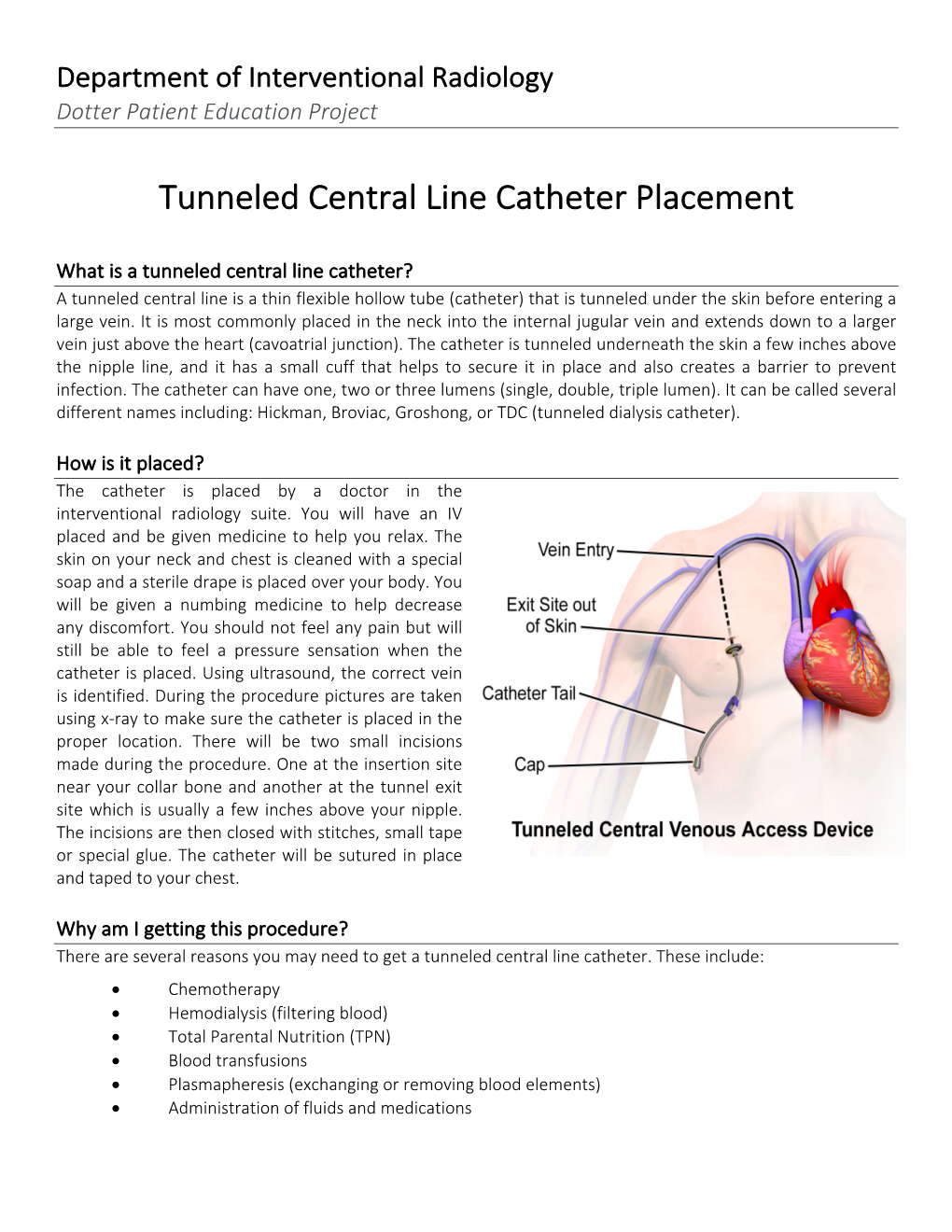 Tunneled Central Line Catheter Placement