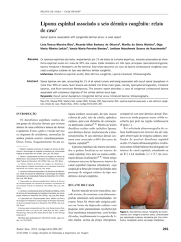 Spinal Lipoma Associated with Congenital Dermal Sinus: a Case Report