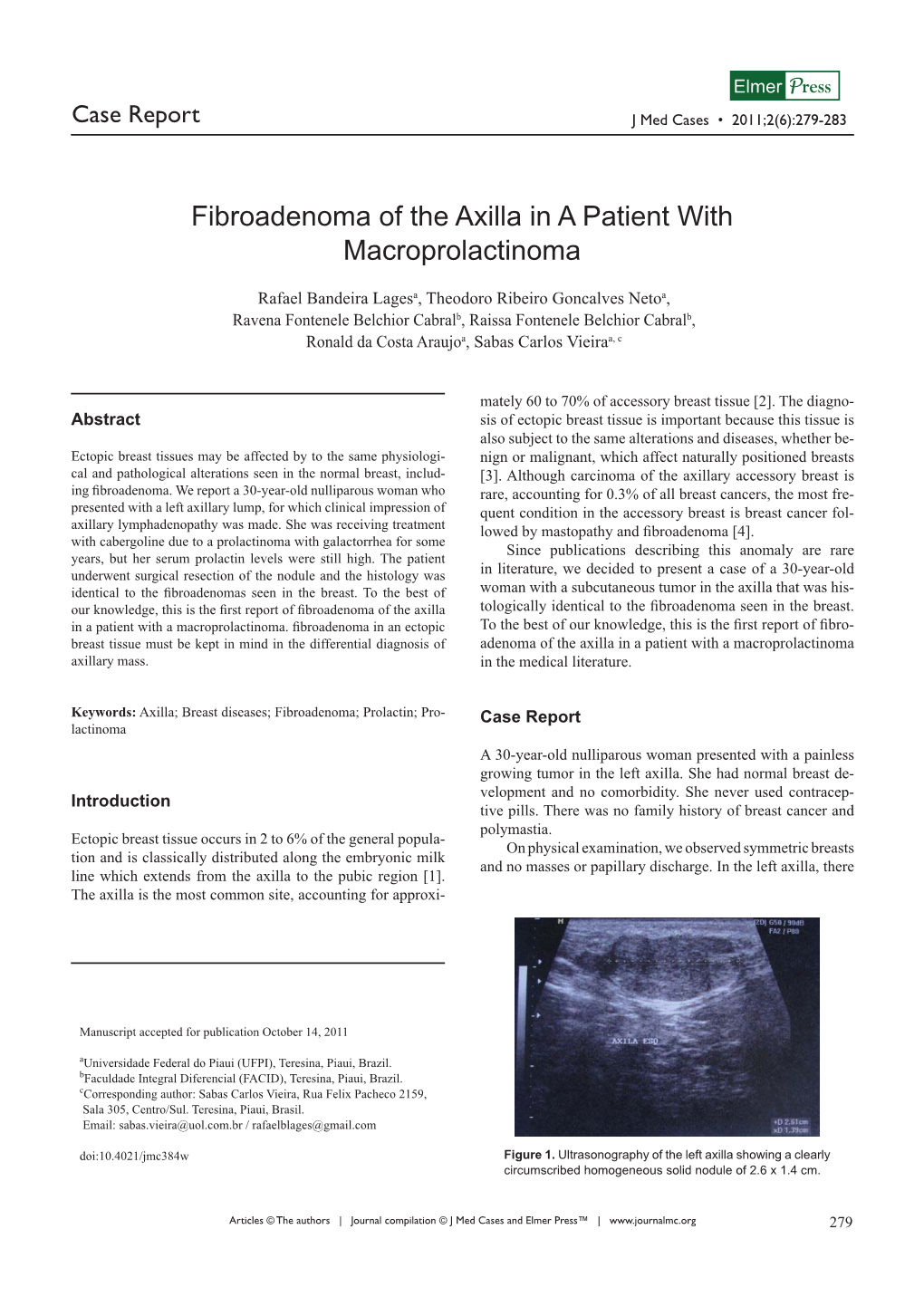 Fibroadenoma of the Axilla in a Patient with Macroprolactinoma